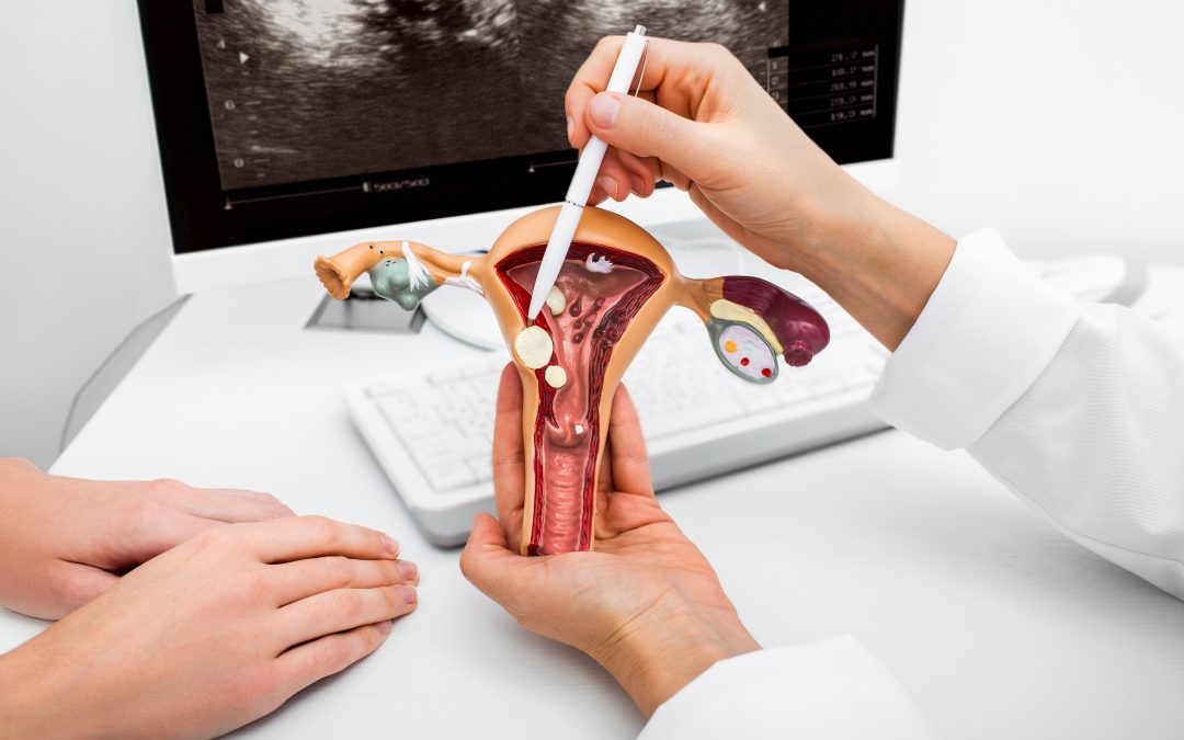 Cómo evitar el cáncer de cuello uterino con controles ginecológicos