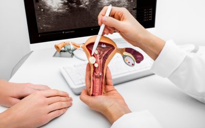 Cómo evitar el cáncer de cuello uterino con controles ginecológicos