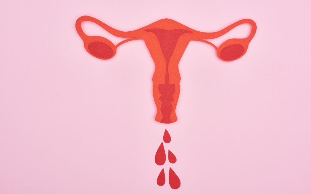 Sangrado uterino anormal: síntomas que no debes ignorar
