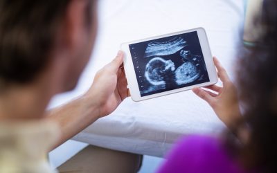 Diferencia entre ecografía 3D y 4D: qué verás en cada una