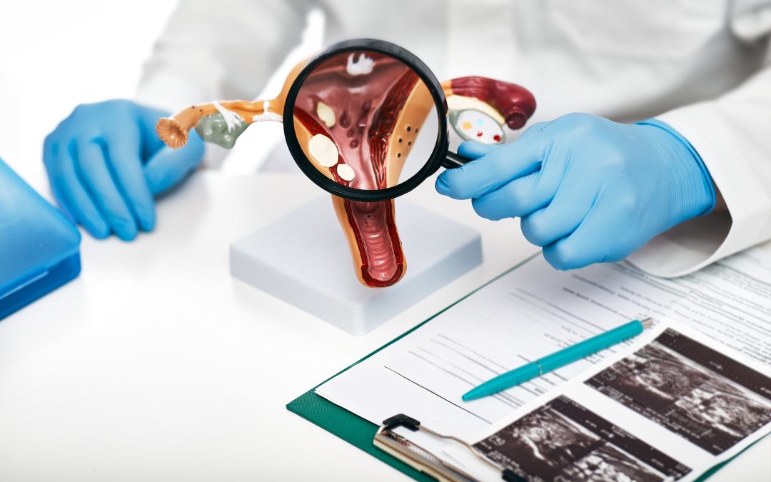 Prevención del cáncer ginecológico: vacunas, cribados y estilos de vida — lo que toda mujer debería saber