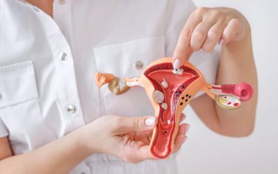 Qué es el SOP y cómo afecta a la salud hormonal femenina